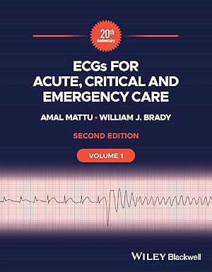 eBook For ECGs for Acute