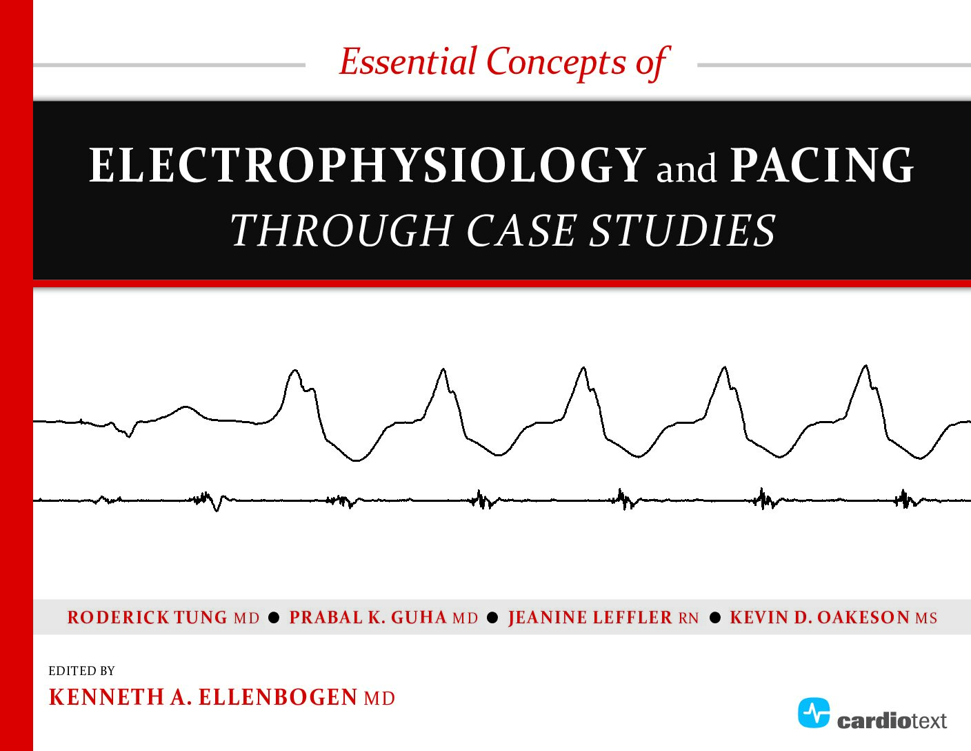 eBook [PDF] Essential Concepts of Electrophysiology and Pacing through Case Studies 1e Kenneth Ellenbogen, Roderick Tung, Prabal Guha, Jeanine Leffler