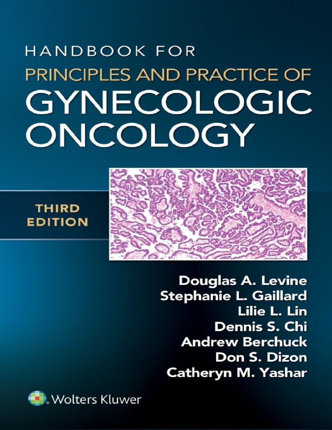 eBook [PDF] Handbook for Principles and Practice of Gynecologic Oncology 3rd Edition By Douglas A. Levine, Lillie Lin, Stephanie Gaillard