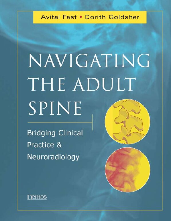 eBook [PDF] Navigating the adult spine bridging clinical practice and neuroradiology By Avital Fast, Dorith Goldsher